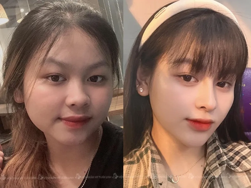 dia-chi-nang-mui-tphcm-4-1 Viện Thẩm Mỹ Tuấn Linh