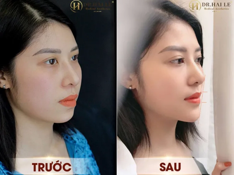 Viện thẩm mỹ y khoa Dr. Hải Lê