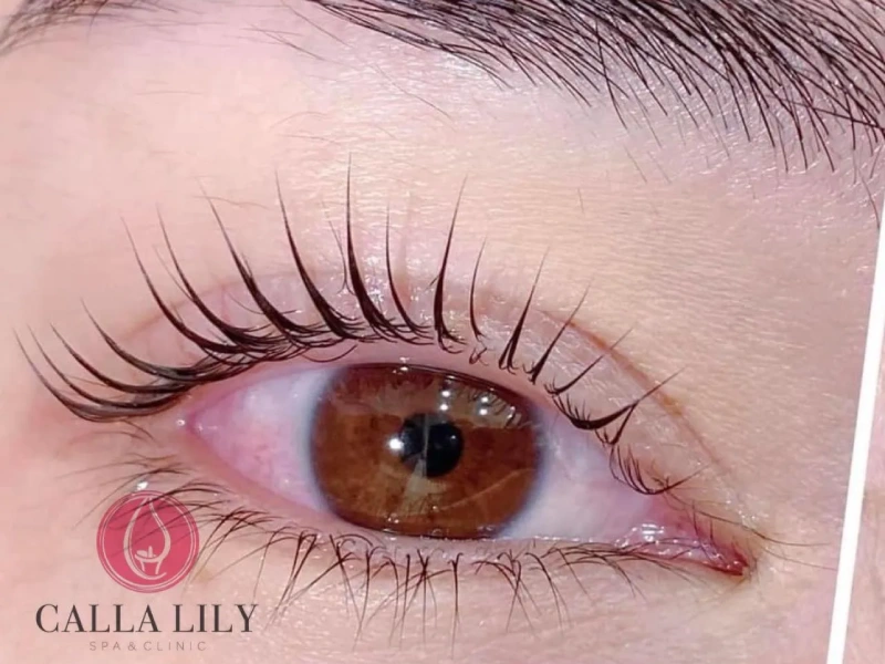 noi-mi-tphcm-3-1 Calla Lily Spa & Clinic