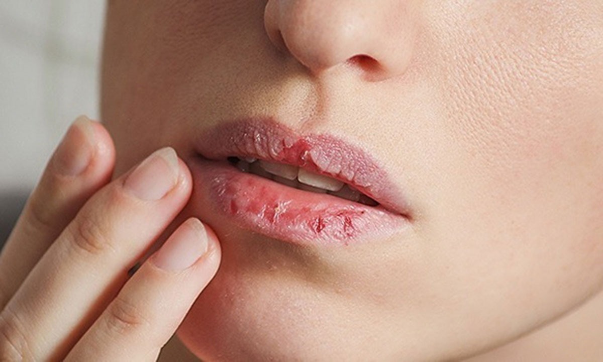 Chăm chỉ dưỡng môi để có đôi môi mềm mượt