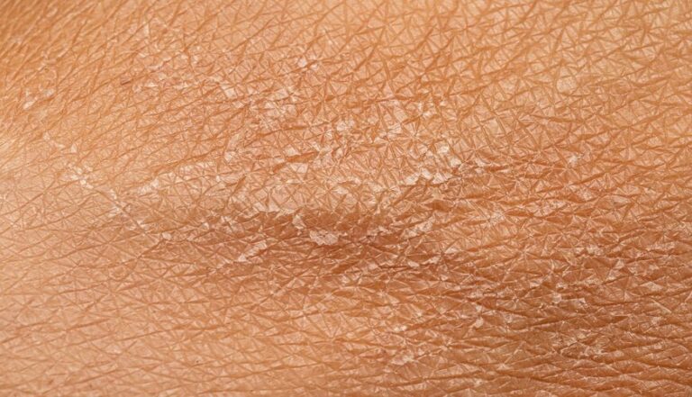 Ngăn ngừa và chăm sóc da khô tróc vảy hiệu quả cho làn da mềm mại