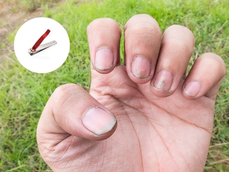 Giữ móng tay ngắn gọn giúp việc vệ sinh dễ dàng hơn