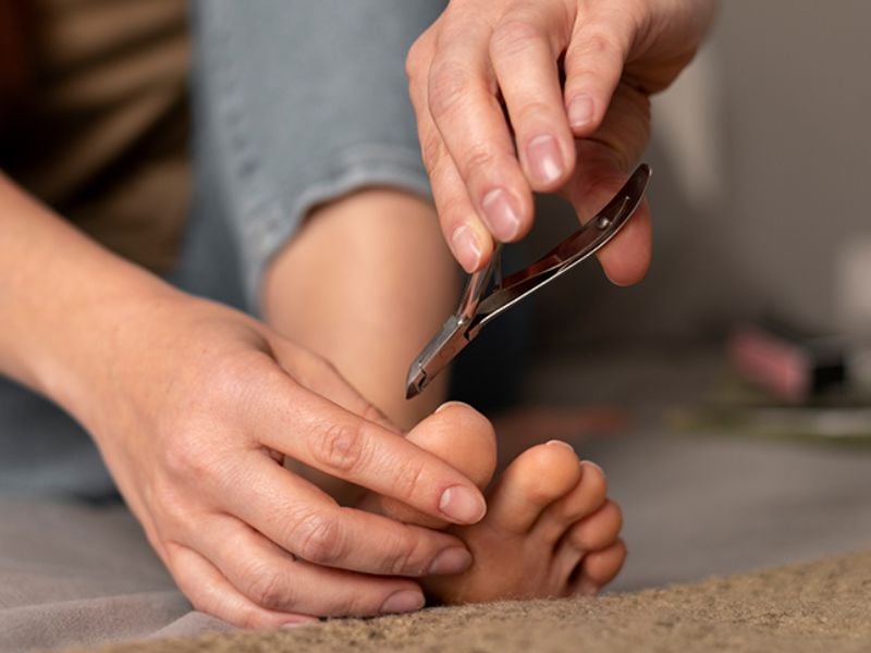 Lấy khóe đúng cách sẽ không gây ảnh hưởng đến sức khỏe