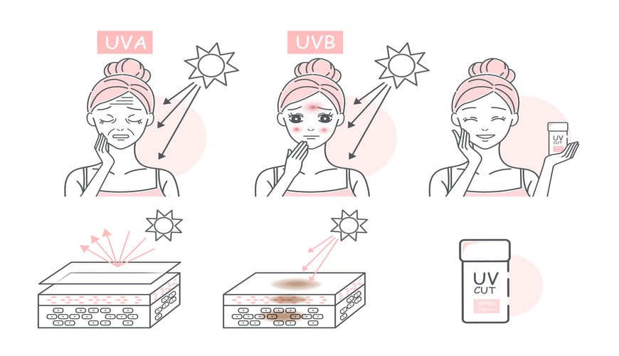 không dùng kem chống nắng dễ gây ra nếp nhăn vùng mắt