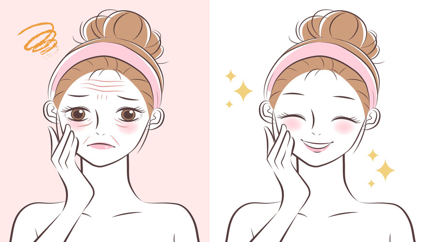 cách điều trị nếp nhăn