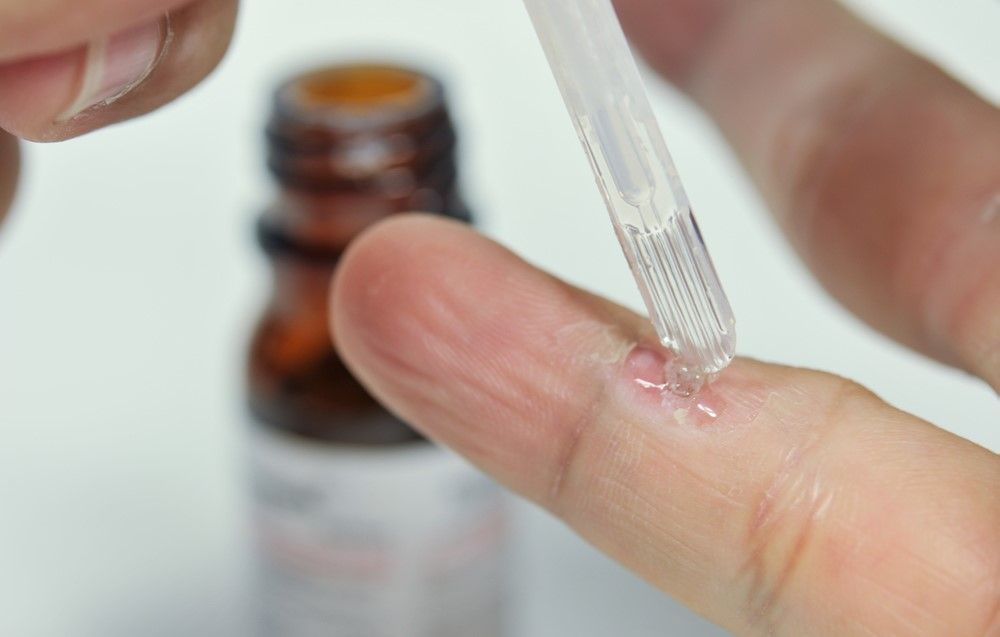 can-su-dong-y-cua-bac-si-khi-dung-salicylic-acid-dieu-tri-mun-coc_eafa5ebaf8554552976124a011f961f7_1024x1024 Cần sự đồng ý của bác sĩ khi dùng Salicylic Acid điều trị mụn cóc