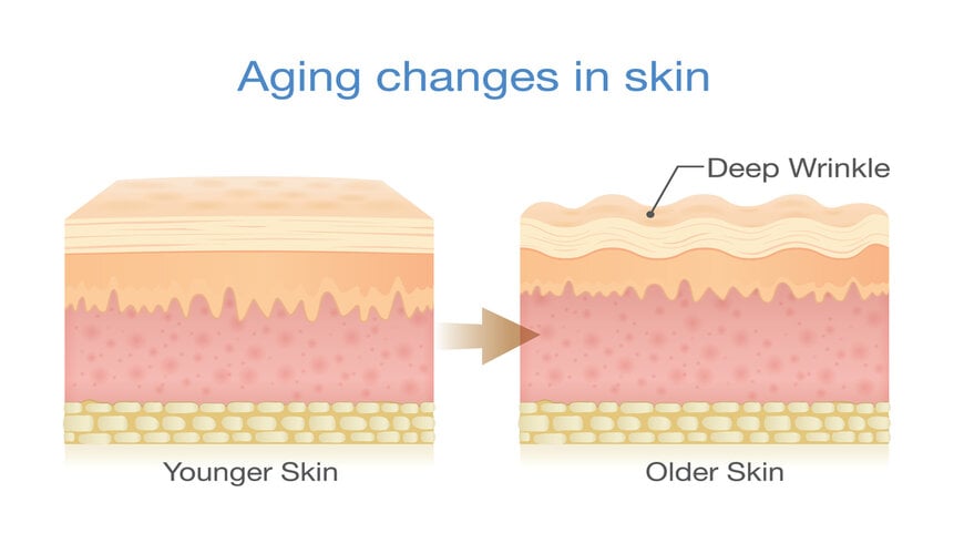 chong_lao_hoa_da_9f322fa790e84ba0be22d091af8f444f da lão hóa