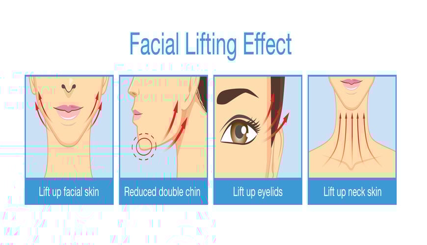 nâng cơ trẻ hóa da mặt