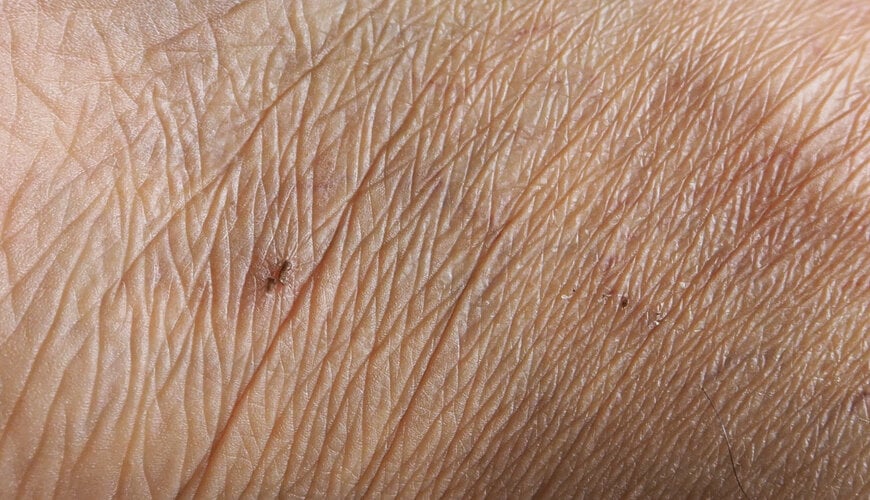 da_hieu_cua_da_lao_hoa_aea9ea1aa4994996b60078a14a866778 biểu hiện của da lão hóa