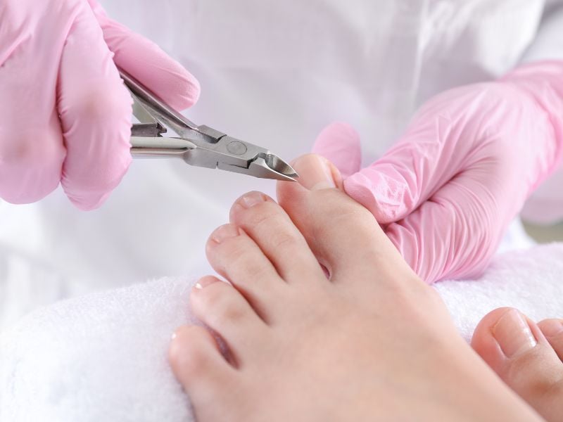 Giữ nguyên lớp biểu bì quanh móng