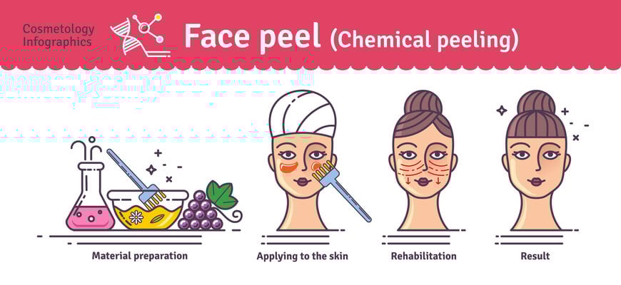 peel_da_la_gi_13a2bddb504f4e6d9ac4b35d25c48655 peel da là gì