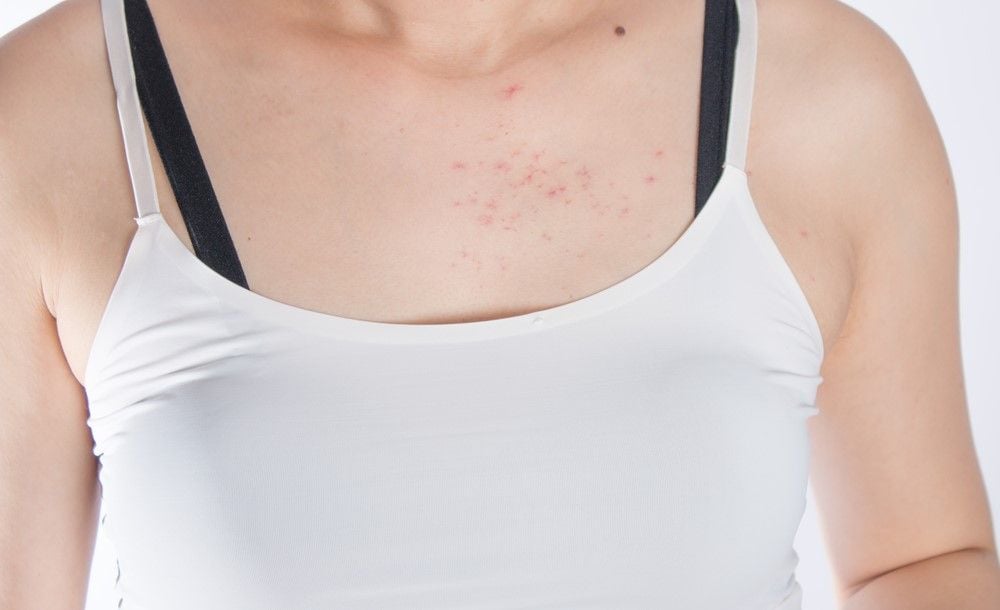 Triệu chứng của viêm nang lông