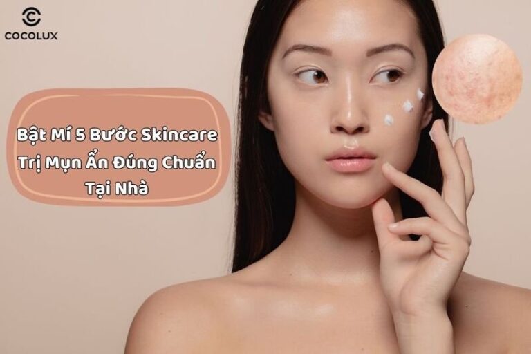 5 bước skincare trị mụn ẩn hiệu quả tại nhà bạn nên thử