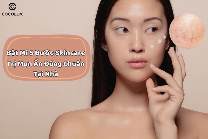 5 bước skincare trị mụn ẩn đúng chuẩn