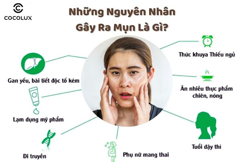 1686880531252-nguyen-nhan-gay-ra-mun các nguyên nhân gây ra mụn cho làn da dầu