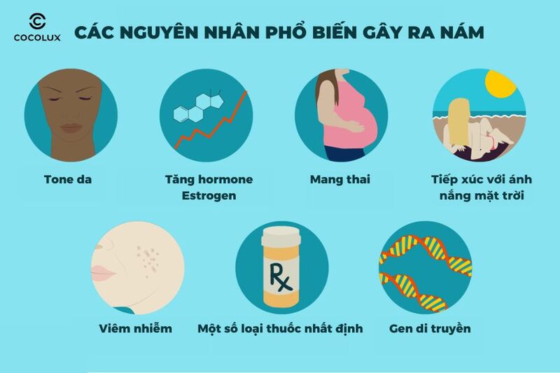 Nguyên nhân hình thành nám da