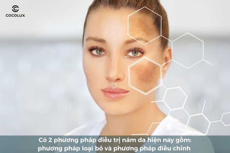 Các phương pháp điều trị nám da hiện nay