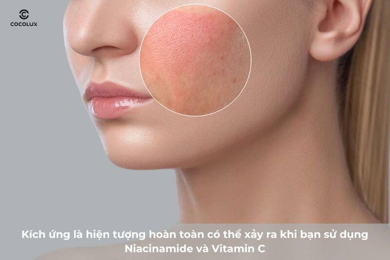 Tác dụng phụ tiềm ẩn khi kết hợp Niacinamide và Vitamin C