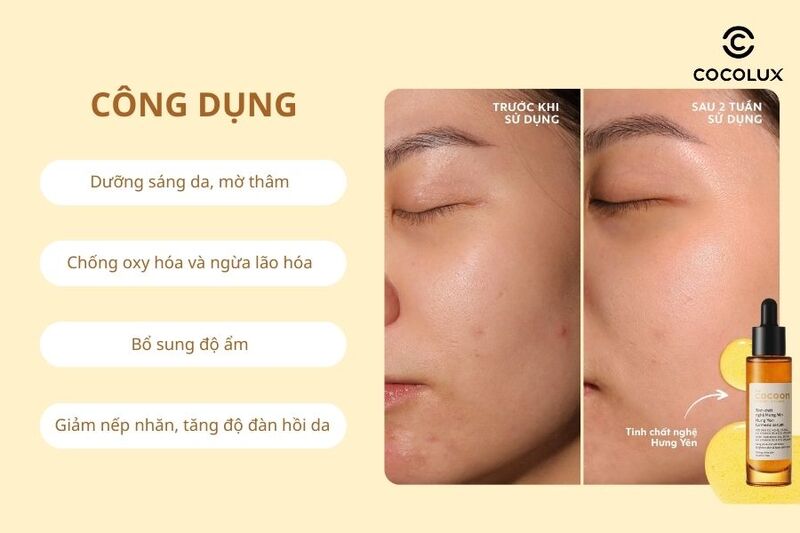 Công dụng của tinh chất Cocoon chiết xuất từ nghệ Hưng Yên